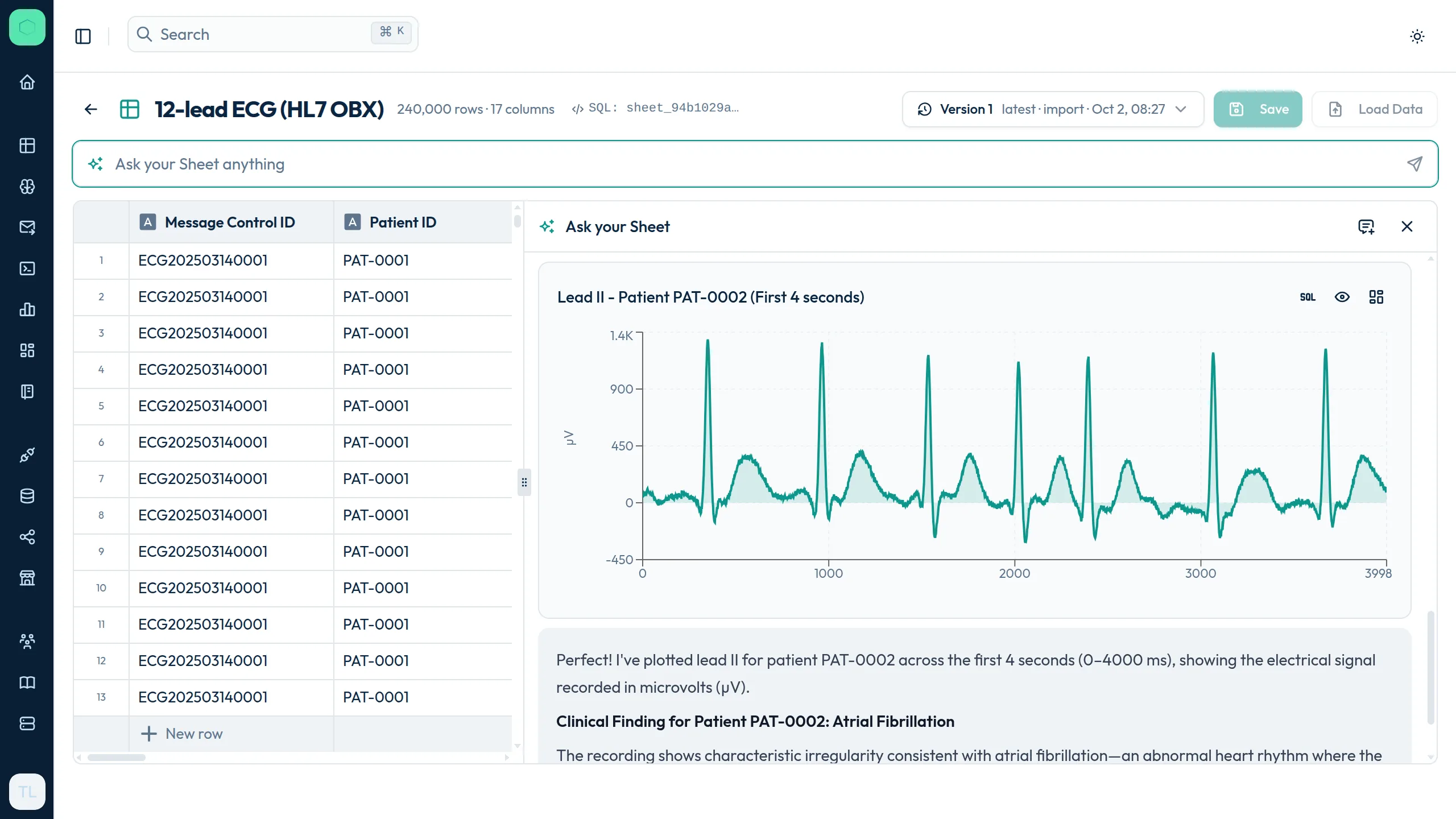Icelake Sheets — a 12-lead ECG loaded from HL7 OBX rows, with the AI chat plotting a 4-second lead II strip of atrial fibrillation